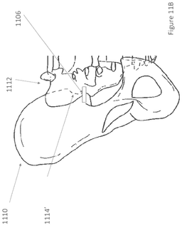 EMI-D00010